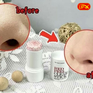 Cong dung thanh lan tri mun Red Peel Clear Stick Blackhead Face Clear Pore Stick